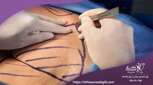 پیکرتراشی-بدن-چیست-انواع-روشهای-پیکرتراشی-بدن